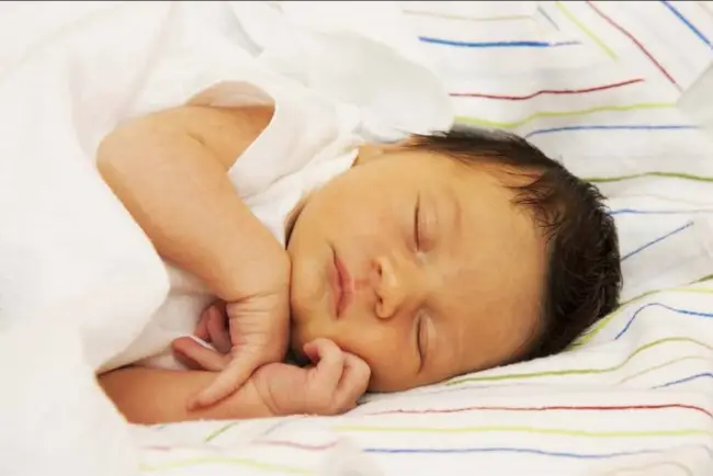 Признаки физиологической желтухи у новорожденных